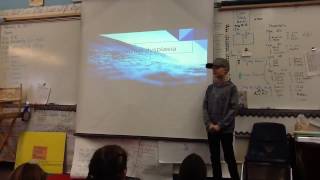 Brave Ten-Year-Old Educates Classmates About Ectodermal Dysplasias and Celebrating Differences