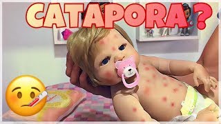 Bebê Reborn com CATAPORA! Levei ao Pediatra! PETER TOYS