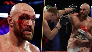 КРОВАВЫЙ БОЙ! Тайсон Фьюри vs. Отто Валлин Обзор, слова после боя, Тайсон в Больнице
