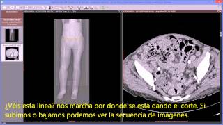Radiant DICOM