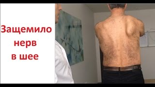Защемило нерв в шее. Торчит лопатка. Неправильная тренировка.
