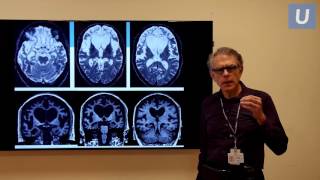 Best Practices & Emerging Therapies for Patients with Alzheimer’s Disease