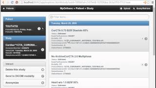 Demo of DICOM Query/Retrieve with Orthanc