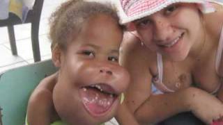 Charity Providing Reconstructive Surgery to Deformed Deformity