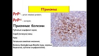 Прионы