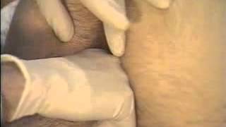 Rectal Examination