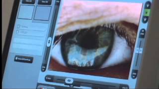 How do you Diagnose Dry Eye?