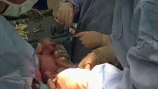 Gerwer Quads Video