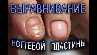 Выравнивание УКРЕПЛЕНИЕ ногтей БАЗОЙ без ОПИЛА✨как исправить КРИВОЙ ноготь.маникюр на КОРОТКИЕ НОГТИ
