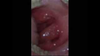 Guinness world record 2012 human biggest clitoris