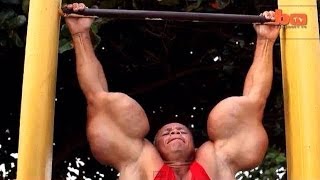 Worse Synthol Abuse EVER! OIL INJECTED INTO THE MUSCLE
