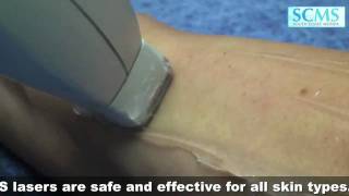 Laser Hair Removal Side Effects