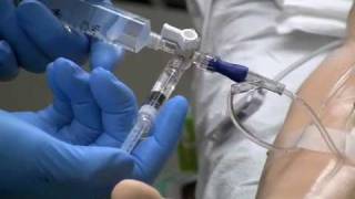 Adenosine Administration