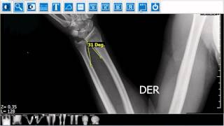 Mednica Dicom Viewer
