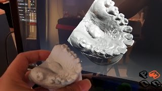 3minutes Dental Scan by David SLS3