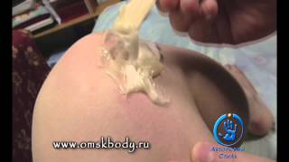 Сахарная депиляция Как надо и не надо делать шугаринг Шпательная техника Токмаков