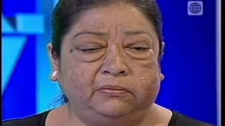 Dr. TV Perú (04-04-2014) - B2 - Tubo de la verdad: Edith- hinchazón en el rostro
