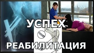 Реабилитация. Остеосинтез Бедренной кость. Гамма гвоздь (GAMMA)