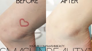 How to cover up a tattoo: waterproof, transfer-proof, long lasting