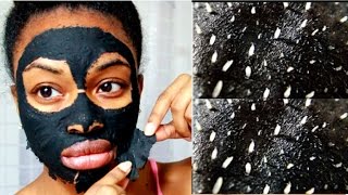 DIY Blackhead and Whitehead Remover Peel Off Mask | BLACK MASK