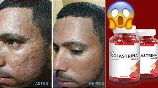 Colastrina Funciona Mesmo? - Depoimento Sincero Feminino