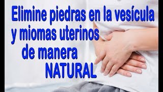 Elimine piedras en la vesícula y miomas uterinos de manera natural