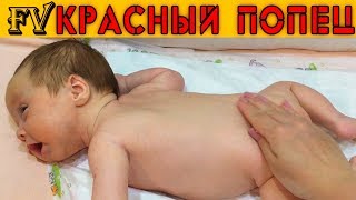 КРАСНАЯ КОЖА И ПОПА У МЛАДЕНЦА