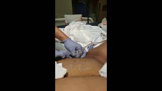 Warning: Graphic Content- Gender Reassignment Surgery (day 5 post op)