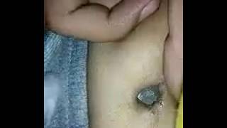 Belly Button torture with a hot glue gun(10 days later)
