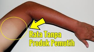 4 CARA PALING JITU MERATAKAN KULIT BELANG DALAM HITUNGAN HARI