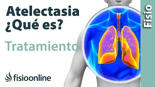 Atelectasia Causas, síntomas y tratamiento desde la visión de la fisioterapia respiratoria