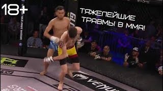 СТРАШНЫЕ ТРАВМЫ БОЙЦОВ 2 (НЕ ДЛЯ СЛАБОНЕРВНЫХ!!!)