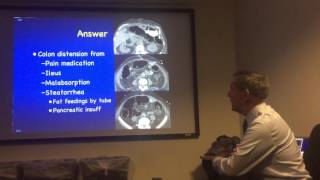 Dr. Scholz,Colonic Distention, MGH
