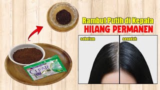 JANGAN DISEMIR... CUCI RAMBUTMU DENGAN INI, UBAN MEMUTIH DI KEPALA HILANG PERMANEN