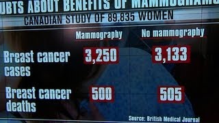 Mammogram study: Test doesn't save lives of women 40-59