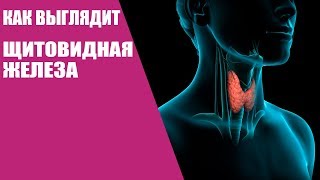 Как выглядит рак щитовидной железы/Операция