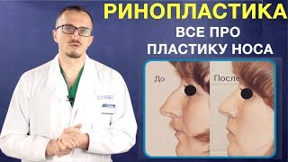 Ринопластика носа. Пластика носа. Изменение формы носа операция. Ринопластика и кифопластика