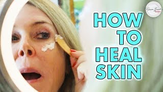 Heal Skin and Repair Sun Damage to your Face and Skin Beauty