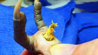 Popping Chicken Blackhead!  Blackheads