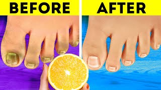 Helpful Feet Hacks, Shoe Tips And Pedicure Tricks