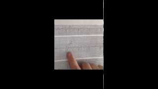 ECG - Oskolok (Pathophysiology)