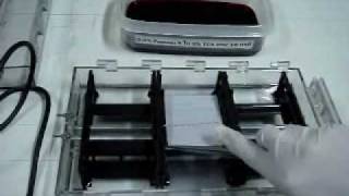 Hb cellulose acetate electrophoresis Part II