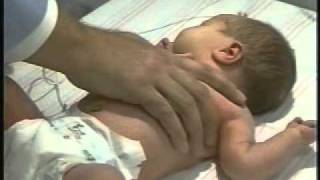 Semiología - Examen neonatal 01
