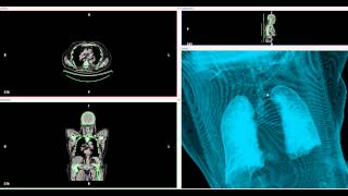 3d dicom viewer