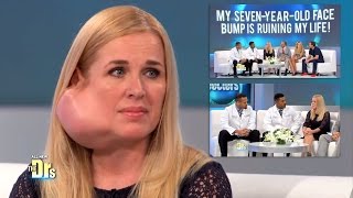 Parotidectomy for Large Facial Tumor Removal: The Doctors TV Show/Osborne Head and Neck Institute