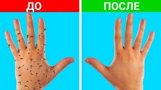 25 ОЧЕНЬ ПОЛЕЗНЫХ ЛАЙФХАКОВ ДЛЯ ПОХОДА
