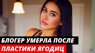 Мексиканская Ким Кардашьян умерла после пластики ягодиц