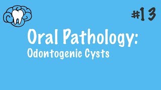 Oral Pathology | Odontogenic Cysts | NBDE Part II