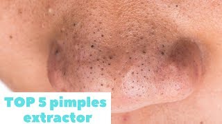 TOP 5 pimples Выдавливание прыщей [2]