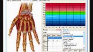 EAV by Dr. Voll and VEGA test methods.